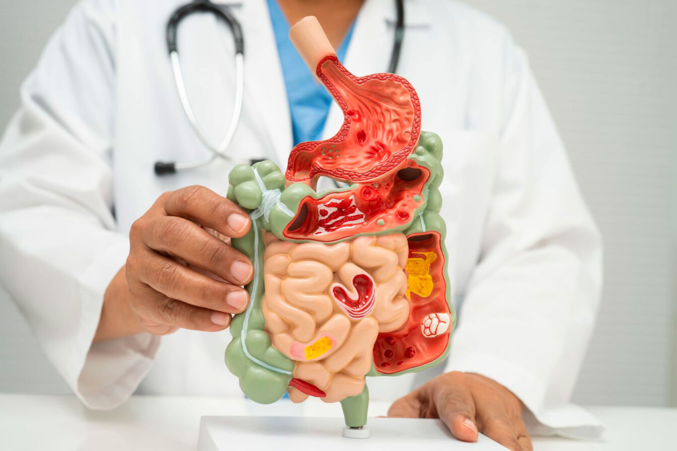 estudio-permeabilidad-intestinal